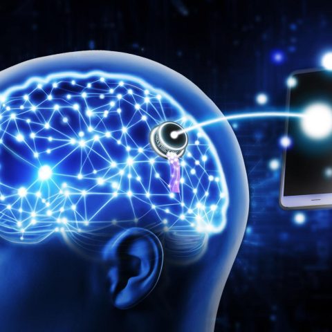 brain implant
